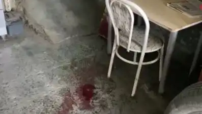 Sandalyeden Düşen Adamın Dramı: Ağır Yaralanma ve Sonrası