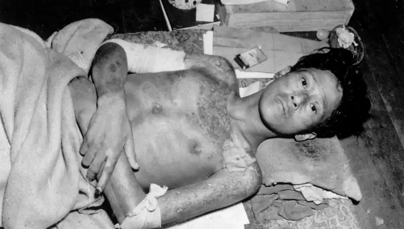 80 Yıl Sonra Nagasaki'den Gelen Uyarı: Nükleer Tehdit Yeniden Kapıda