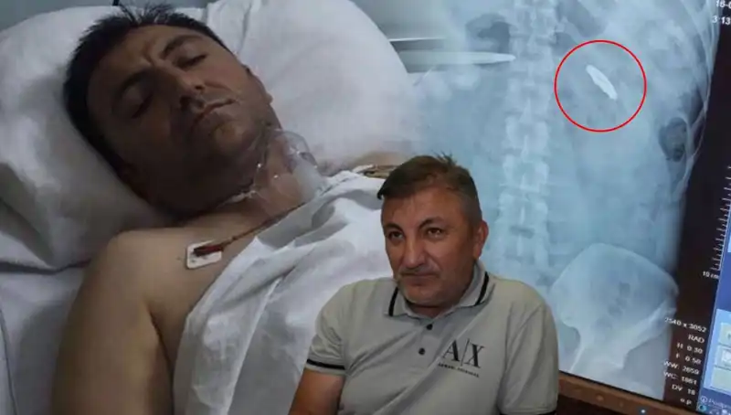 15 Temmuz’da Aldığı Yaralarla Yaşayan Kahraman: Kurşunla 9 Yıl Geçti