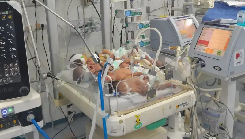 Gazzeli Doktorlar Çağ Dışı Koşullarda Mücadele Ediyor: "Aynı Kuvözde Birden Fazla Bebek"
