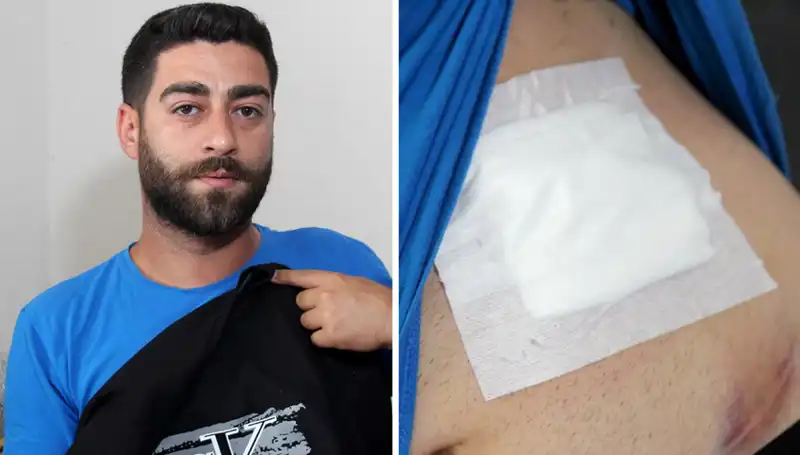 Karnında Hissettiği Ağrının Nedeni Korkunçtu: Röntgen Gerçeği Ortaya Çıktı