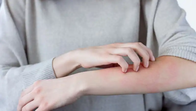 Dermatologdan Şaşırtıcı Açıklama: Cilt Kanserinin Gizli Belirtileri