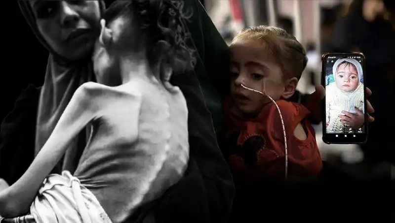 Küçük Meryem’in Acı Hikayesi: 25 Kilodan 10 Kiloya Düşen Çocuk Açlıkla Savaş Veriyor