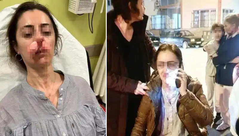 Eşinin Sevgilisi Sandığı Kişiyi Araba Kapısıyla Vurdu!